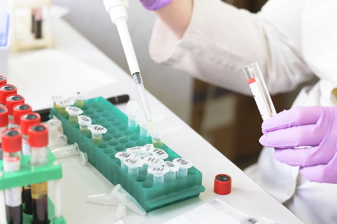 laboratory, medical, medicine, ręka, research, lab, test, doctor, equipment, scientist, kobieta, chemistry, science, hospital, experiment, osoba, technician, technology, healthcare, praca, health, tube, work, research lab, blood samples, laboratory, laboratory, laboratory, lab, lab, lab, lab, lab, doctor, chemistry, hospital, hospital