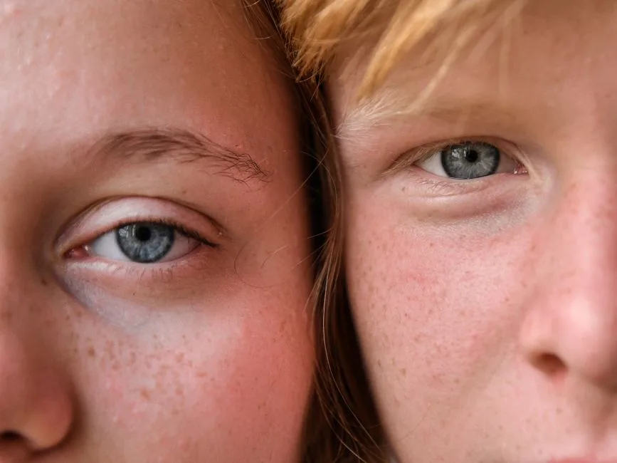 A close-up image capturing the intricate details of two people's eyes and skin texture with visible freckles.