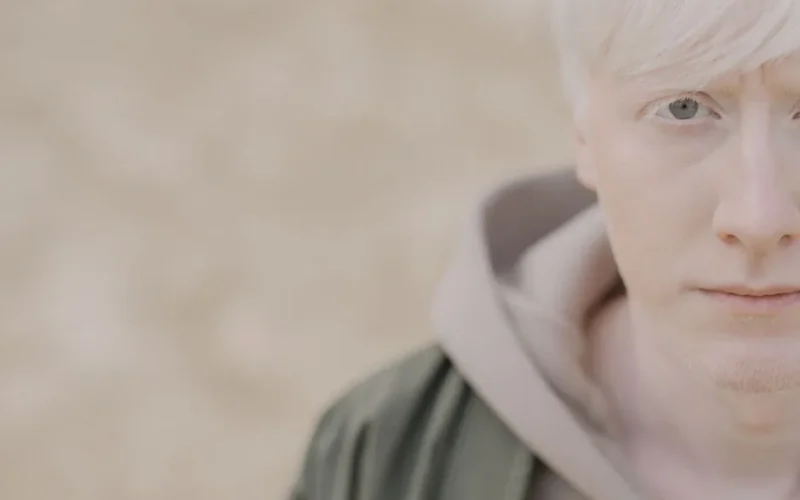 Close-up portrait of a young albino man looking at the camera outdoors with a serene expression.